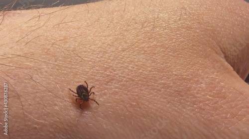 Tick crawling on the skin. High risk of infection with a tick-borne disease such as Lyme disease.