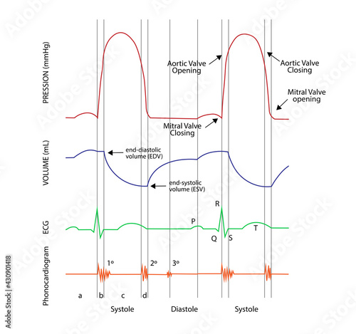 Left ventricular pressure-volume (PV) loops, electrocardiogram (ECG) and Phonocardiogram curves photo