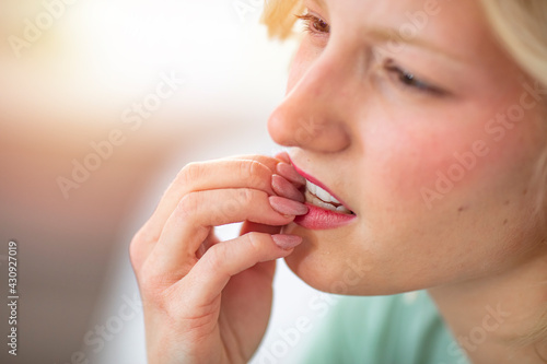 Close Up Of Nervous Woman Biting Nails. Portrait of 30 years old woman biting her fingernails. Woman nibbles nails when feels stress or nervous. People  bad habits and medicine concept