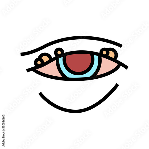 blepharitis disease, redness of eyeball color icon vector. blepharitis disease, redness of eyeball sign. isolated symbol illustration