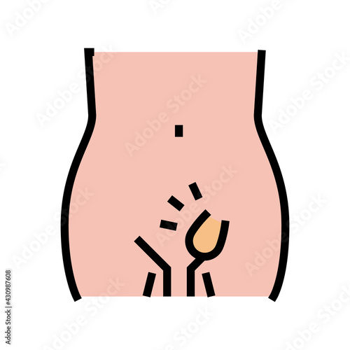 hernia inguinal disease color icon vector. hernia inguinal disease sign. isolated symbol illustration