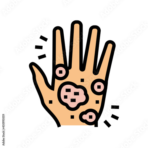 hand eczema color icon vector. hand eczema sign. isolated symbol illustration