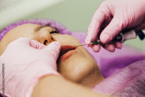 Woman gets an injection with hyaluronic acid as a dermal filler for lip enlargement