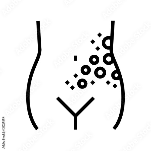 lichen shingles disease line icon vector. lichen shingles disease sign. isolated contour symbol black illustration
