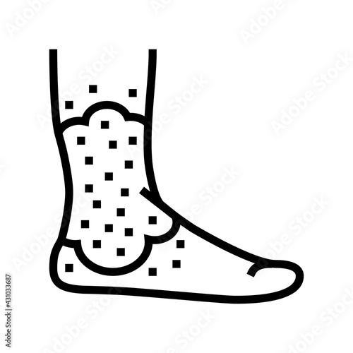 stasis dermatitis line icon vector. stasis dermatitis sign. isolated contour symbol black illustration