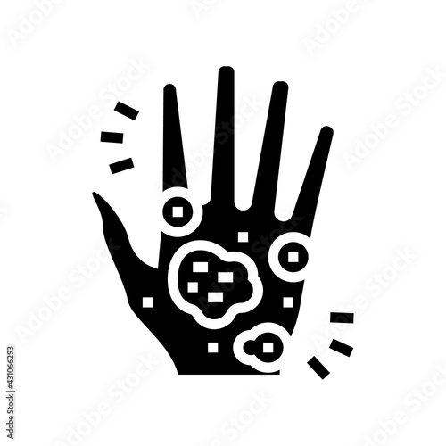 hand eczema glyph icon vector. hand eczema sign. isolated contour symbol black illustration