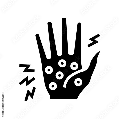 dyshidrotic eczema glyph icon vector. dyshidrotic eczema sign. isolated contour symbol black illustration