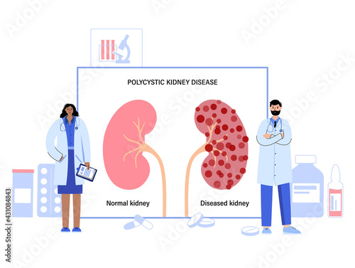 Kidney disease concept