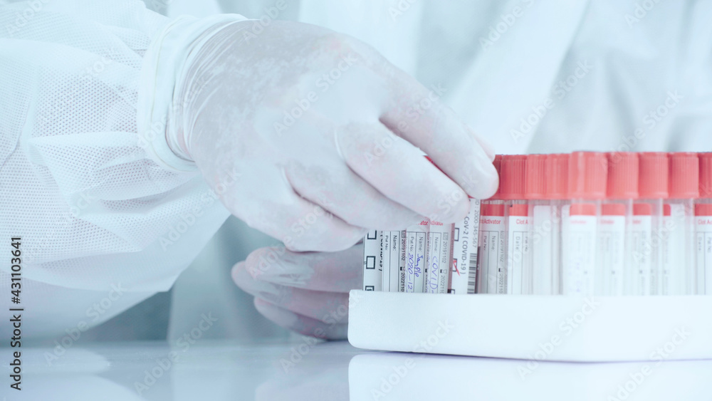 Close up laboratory worker hold blood sample in tube and place on rack. Close up laboratory worker hold blood sample in tube and place on rack.