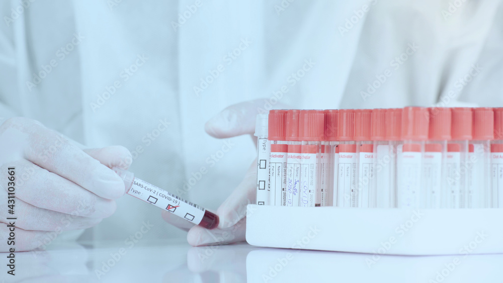 Close up laboratory worker hold blood sample in tube and place on rack. Close up laboratory worker hold blood sample in tube and place on rack.