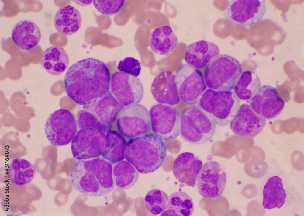Naklejka premium Mixed stage white blood cell on red cells background.