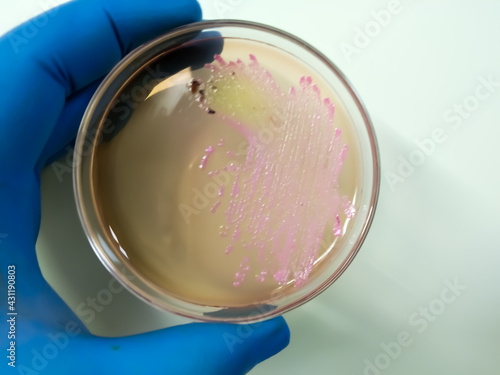 Salmonella colonies on ss agar, salmonella black colonies, Enterobacteriaceae, Microbiology