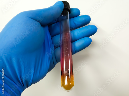 Принти на полотні Fermentation reaction and hydrogen sulfide production in Triple sugar iron (TSI) agar tubes