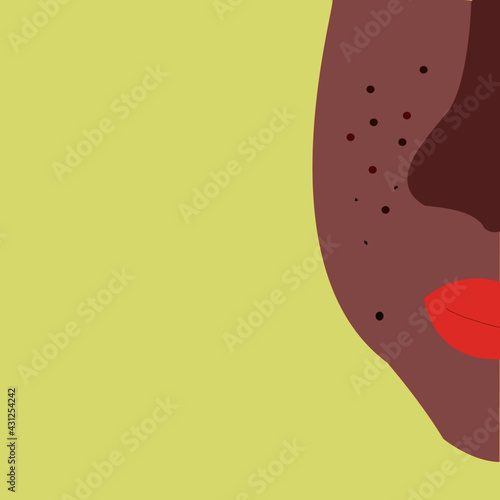Female face with acne
