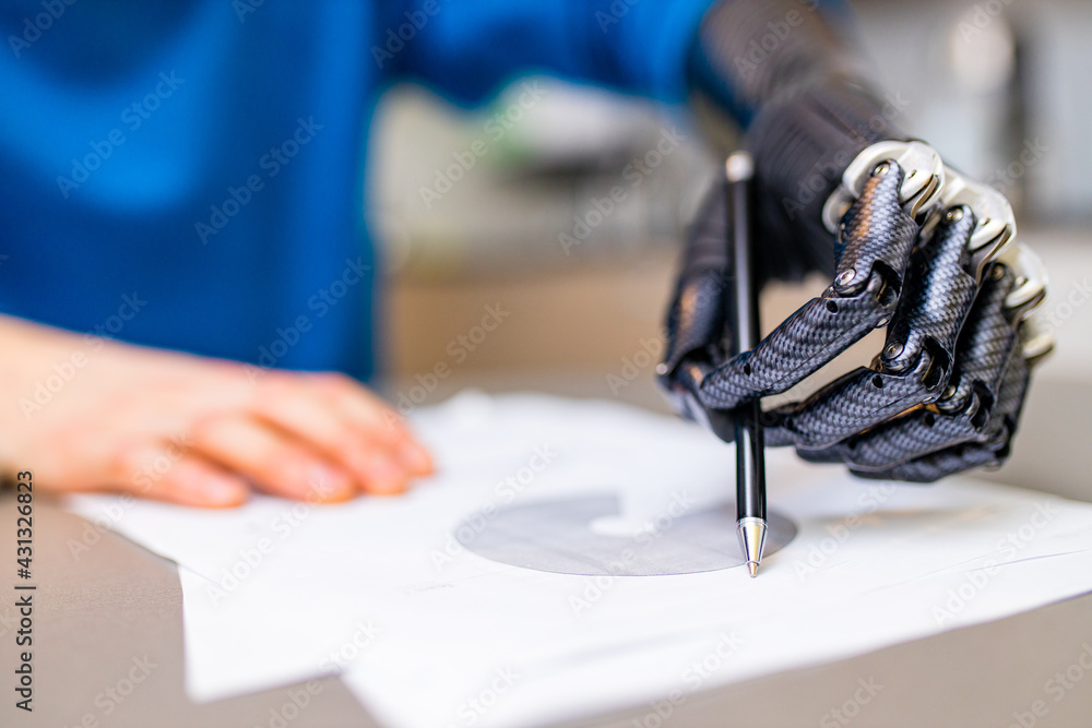 man with prosthetic hand writing development at home man with prosthetic hand writing development at home