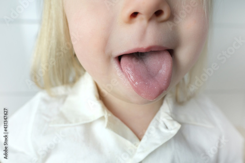 little child, baby, blonde girl showing tongue, mouth close-up, , concept of speech disorders, correction, frenum of tongue, methods of correctional developmental exercises