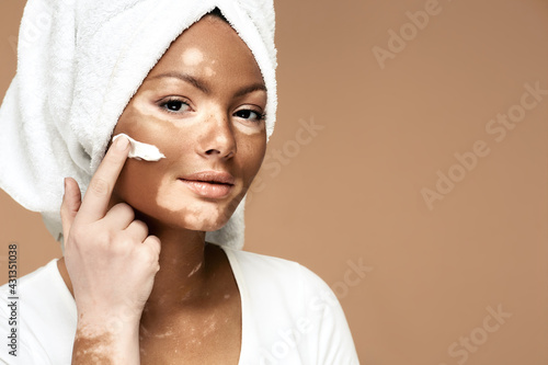 Moisturizing skin concept. African American woman with vitiligo applies moisturizing cream on her face, on a pastel background photo