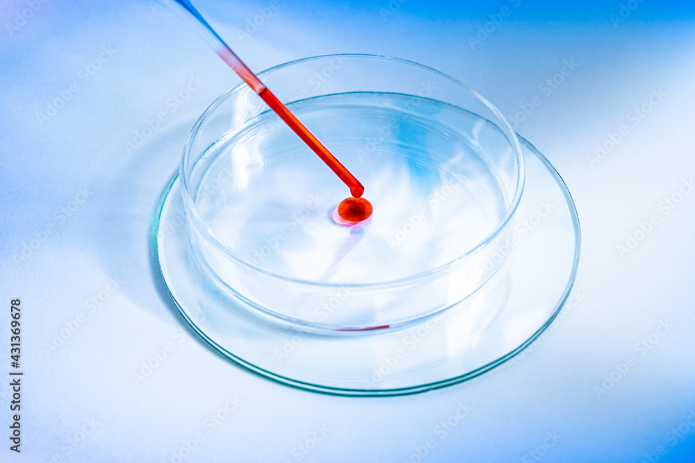 Macro close up of scientist or doctor working with blood. Covid 19 blood test concept. Glass pipette and Petri dish. Coronavirus variant test. Vaccine side effects and allergic reaction research. Macro close up of scientist or doctor working with blood. Covid 19 blood test concept. Glass pipette and Petri dish. Coronavirus variant test. Vaccine side effects and allergic reaction research.