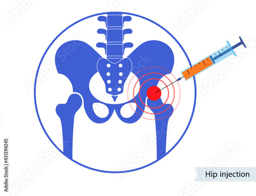 Hip joint injection