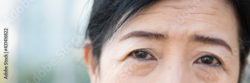 Foto old aging senior woman having wrinkle facial skin and crow’s feet on her face, c
