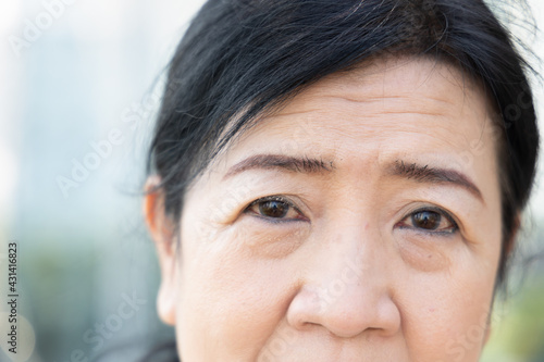 Schilderij op canvas old aging senior woman having wrinkle facial skin and crow’s feet on her face, c