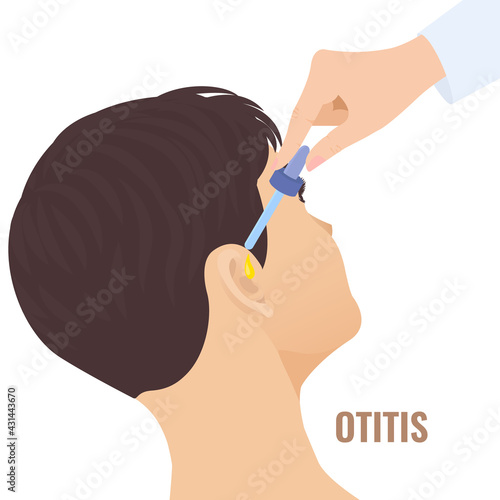 Doctor putting in the drops to the patient ear. Otitis disease treatment. Remedy for hearing problems. Earache as a symptom of coronavirus. Medical vector illustration.