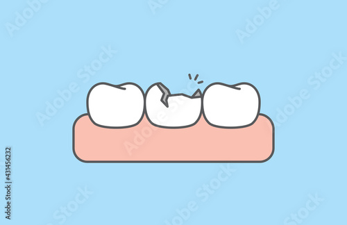 The broken tooth white teeth and gums illustration vector design on blue background. Dental care concept.
