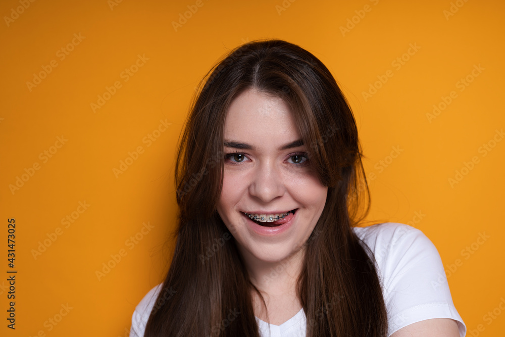 Cheerful girl with braces smiles opening her mouth and biting her tongue and looking at the camera Cheerful girl with braces smiles opening her mouth and biting her tongue and looking at the camera