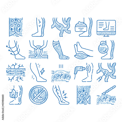 Varicose Veins Disease icon hand drawn illustration