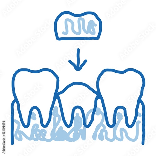 Stomatology Tooth Crown doodle icon hand drawn illustration