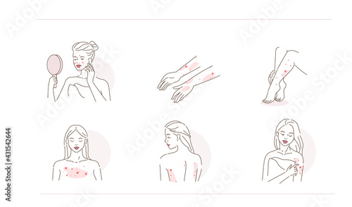 Beauty Girl Have Allergy and Acne Skin Problems. Woman Scratching her Body and Face with Hand. Allergic Dermatitis, Eczema or Nettle Rash with Itch Symptoms. Flat Line Cartoon Vector Illustration.