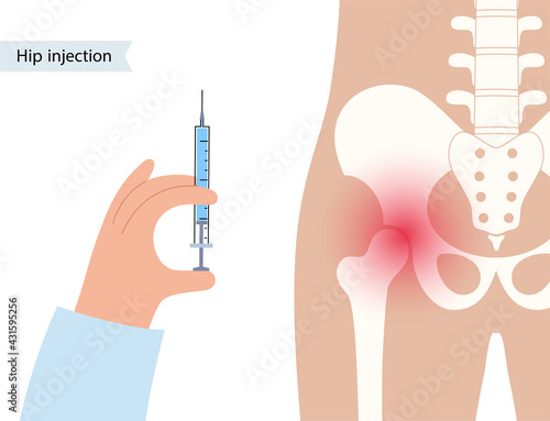 Hip joint injection