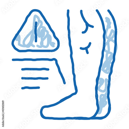 cold feet due atherosclerosis, health problem doodle icon hand drawn illustration