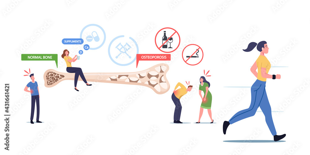 Osteoporosis, Health Care Concept. Tiny Male Female Characters with Bones Disease Symptoms near Huge Bone Cross Section Osteoporosis, Health Care Concept. Tiny Male Female Characters with Bones Disease Symptoms near Huge Bone Cross Section