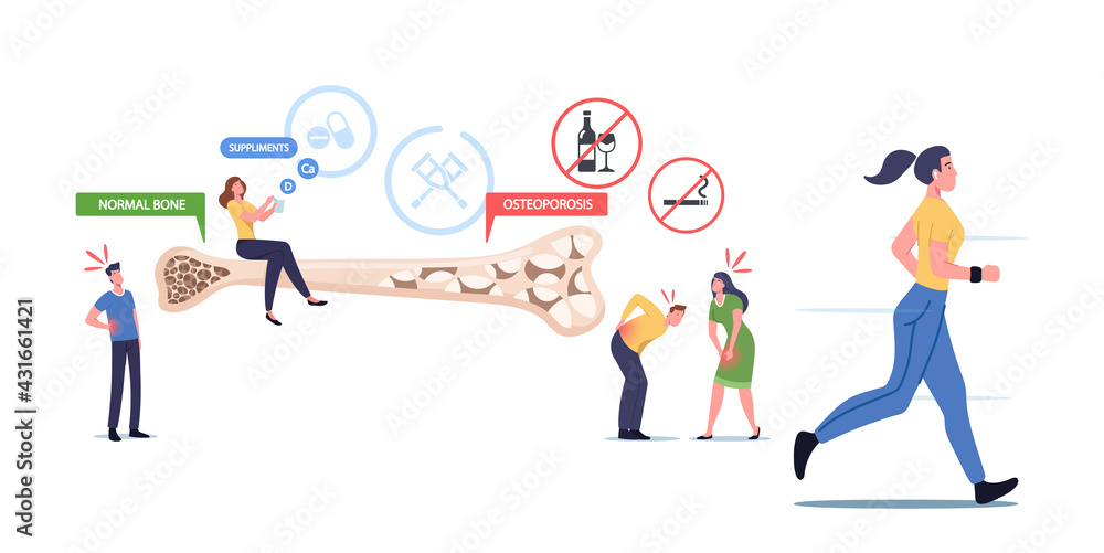 Osteoporosis, Health Care Concept. Tiny Male Female Characters with Bones Disease Symptoms near Huge Bone Cross Section