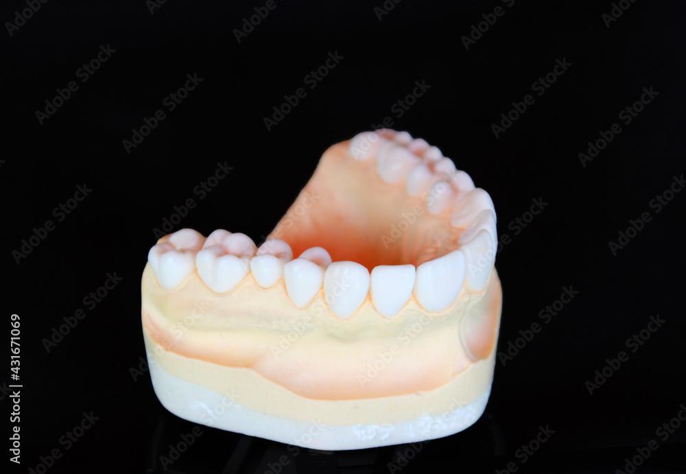 Waxing the loosing teeth for dental treatment plan Waxing the loosing teeth for dental treatment plan