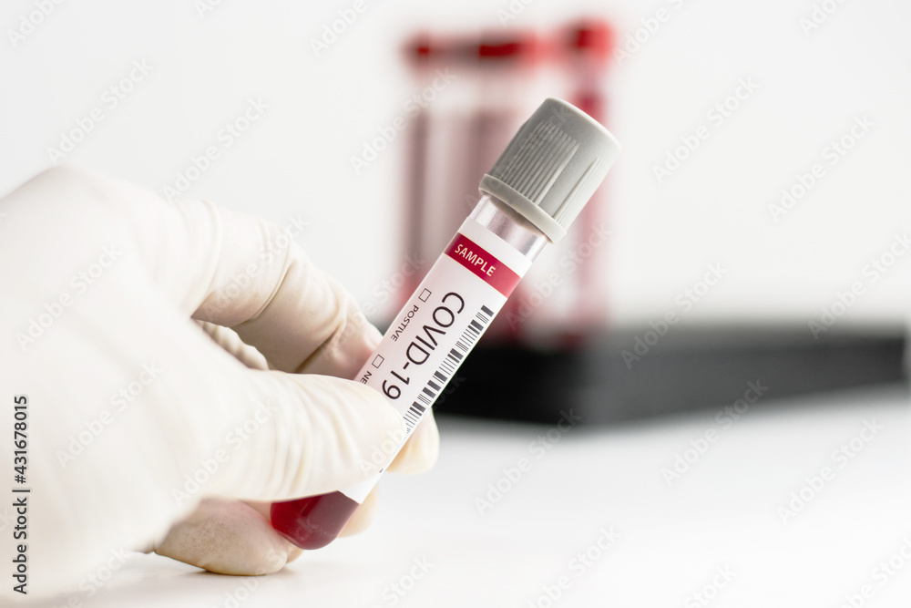 Fototapeta premium Hand wear glove holding blood test tube with covid - 19 code for corona virus.