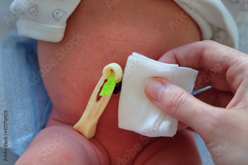 mother in the hospital doing umbilical cord care for her 1-day-old child photo