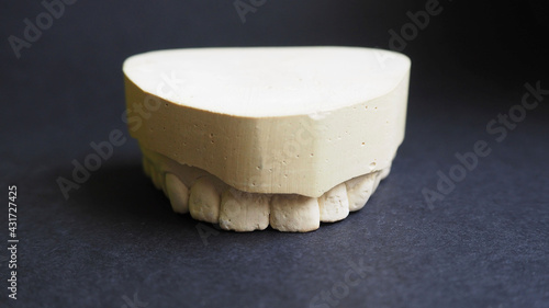 Fotografie the plaster upper jaw lies on a black background, front view