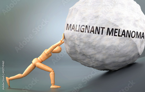 Malignant melanoma and painful human condition, pictured as a wooden human figure pushing heavy weight to show how hard it can be to deal with Malignant melanoma in human life, 3d illustration