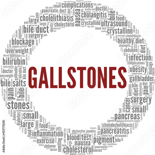 Gallstones vector illustration word cloud isolated on a white background.