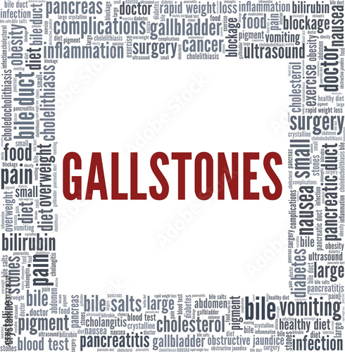 Gallstones vector illustration word cloud isolated on a white background.