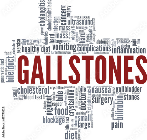 Gallstones vector illustration word cloud isolated on a white background.