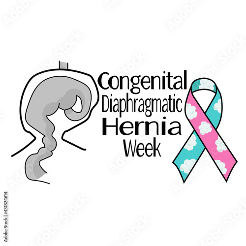 Congenital Diaphragmatic Hernia Week, schematic illustration of hernia of the diaphragm and symbolic cloud ribbon, for poster or banner