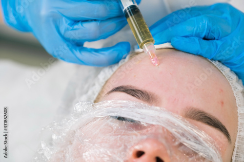 PRP therapy in beauty clinic. Cosmetologist doing injections of blood plasma to womans forehead to cure problem skin, closeup top view. Treatment of skin in cosmetology for young female. photo