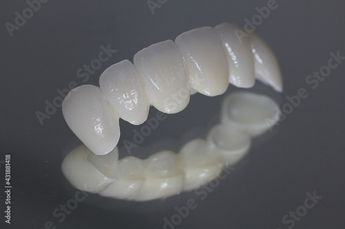 Zirconia bridge with all-porcelain. Zirconium crown