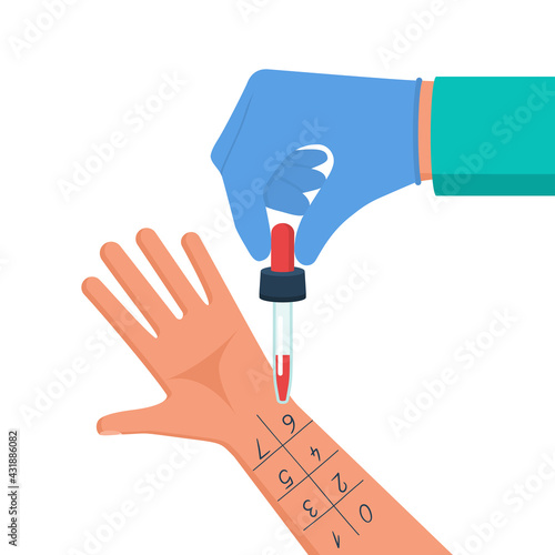 Allergy test. Doctor holds pipette in hand for research. Medical vector illustration flat design. Laboratory equipment for analysis. Patient with an allergic reaction. Isolated on white background.