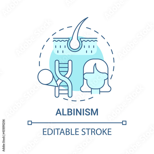 Albinism blue concept icon. No color in hair. Hereditary physical condition. Inherited genetic disorder idea thin line illustration. Vector isolated outline RGB color drawing. Editable stroke