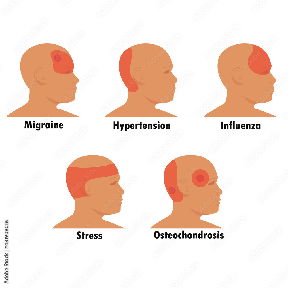Low Blood Pressure Headache Top Sellers Cityofclovis low-blood-pressure-headache-top-sellers-cityofclovis