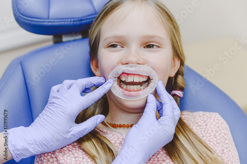 Portrait of little girl wearing dental gag lying in dentists chair during exam